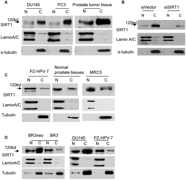 Aberrant Cytoplasm Localization and Protein Stability of SIRT1 is