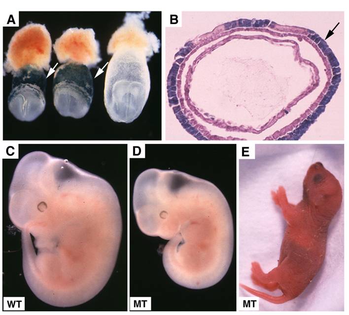 Anterior Visceral Endoderm SMAD4 Signaling Specifies Anterior Embryonic