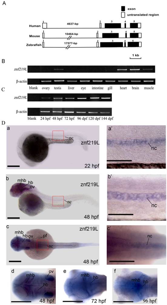 A Novel Zinc Finger Protein 219like (ZNF219L) is Involved in the