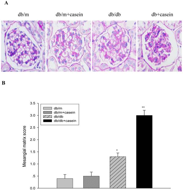 Establishment of an Inflamed Animal Model of Diabetic Nephropathy