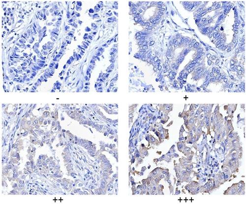 Int J Biol Sci Image