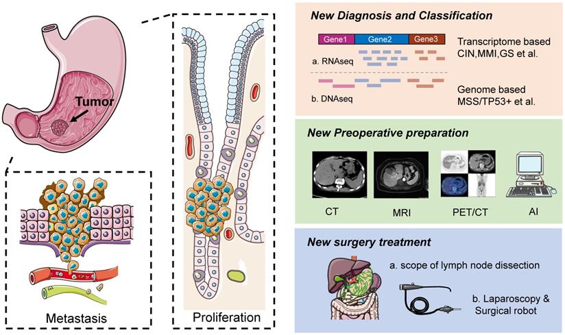 Progress of Gastric Cancer Surgery in the era of Precision Medicine