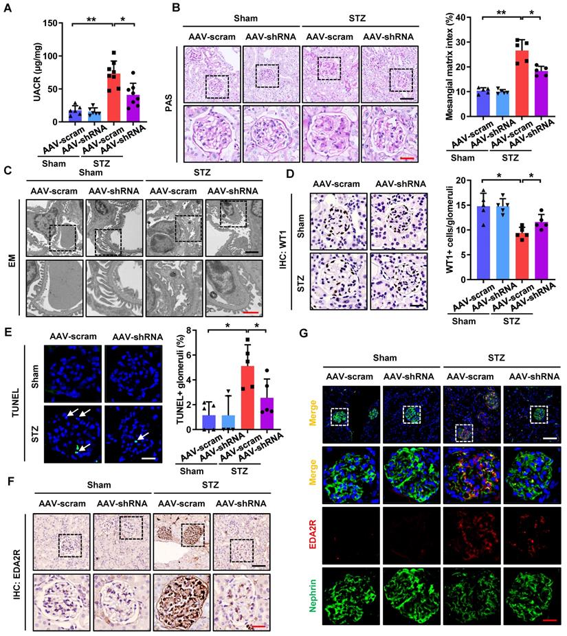 Regulation of Podocyte Injury by CircHIPK3/FUS Complex in Diabetic ...