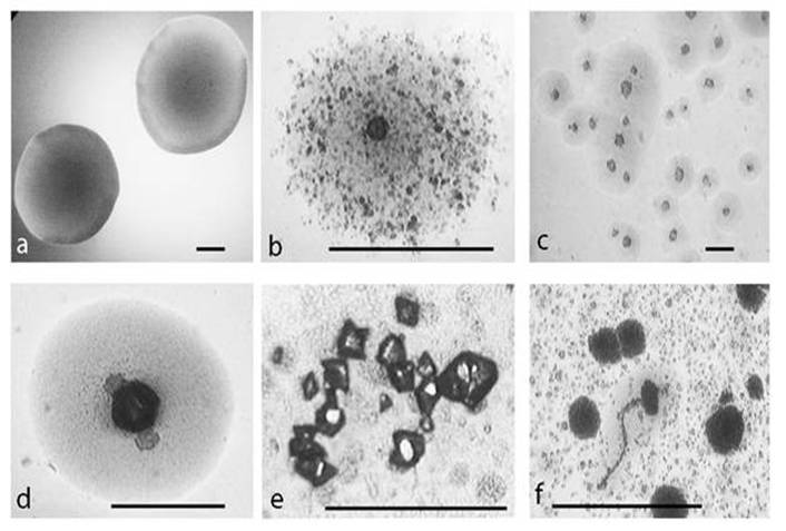 Survival Of Escherichia Coli Under Lethal Heat Stress By L Form Conversion