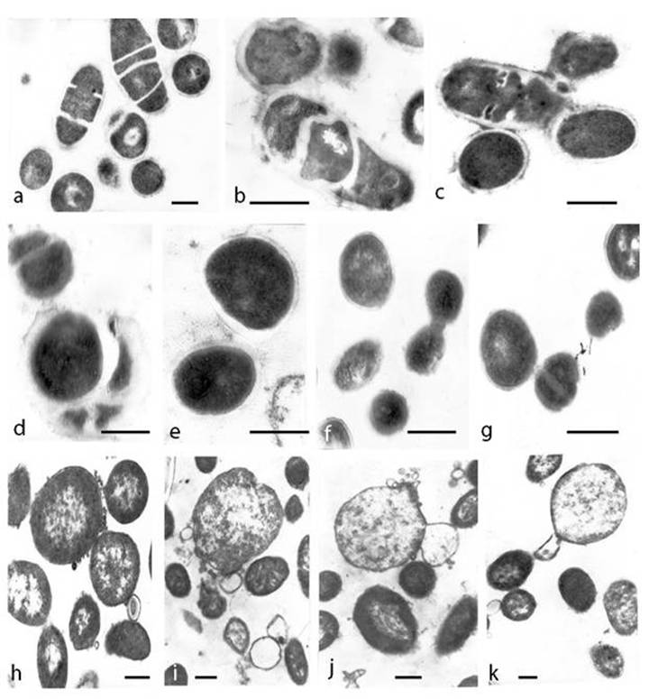 Survival Of Escherichia Coli Under Lethal Heat Stress By L Form Conversion