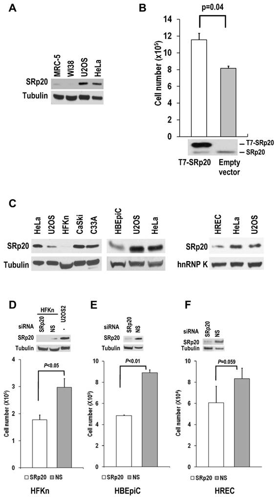 SRp20 is a proto-oncogene critical for cell proliferation and tumor ...