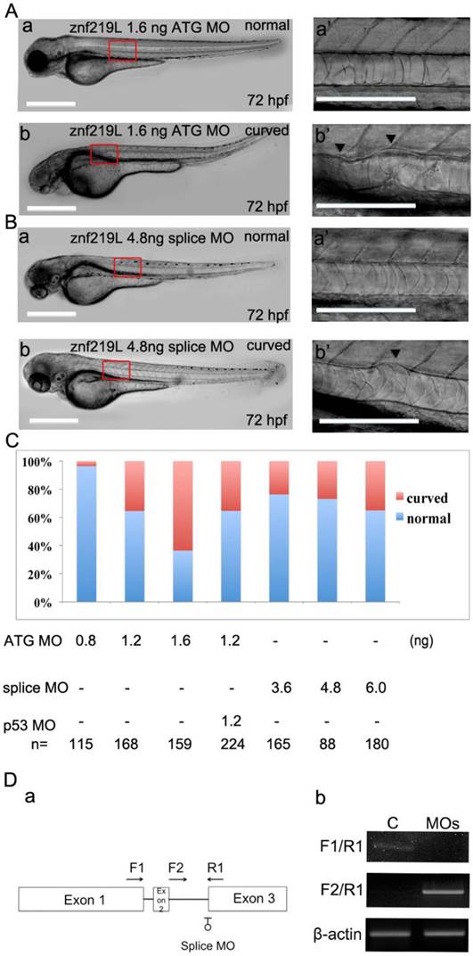A Novel Zinc Finger Protein 219like (ZNF219L) is Involved in the
