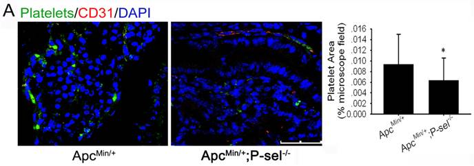 P-Selectin-Mediated Adhesion between Platelets and Tumor ...
