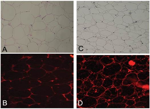 persistence of cd34 stem marker in human lipoma: searching for