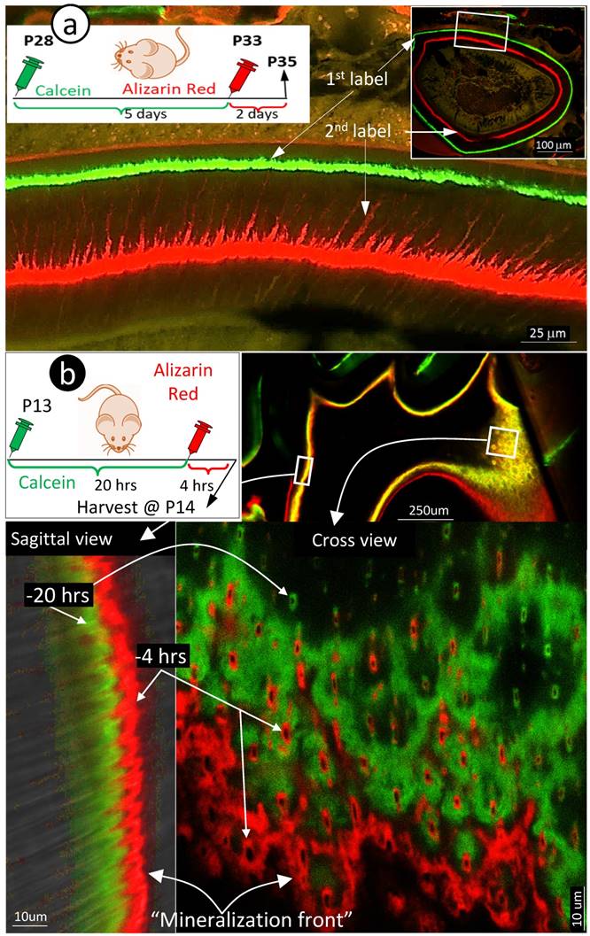 Dentinal mineralization is not limited in the mineralization front but
