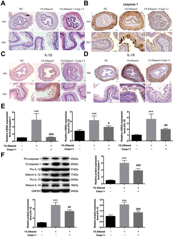 Alcohol accumulation promotes esophagitis via pyroptosis activation