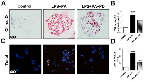 Polydatin Attenuates Diet Induced Nonalcoholic Steatohepatitis And Fibrosis In Mice