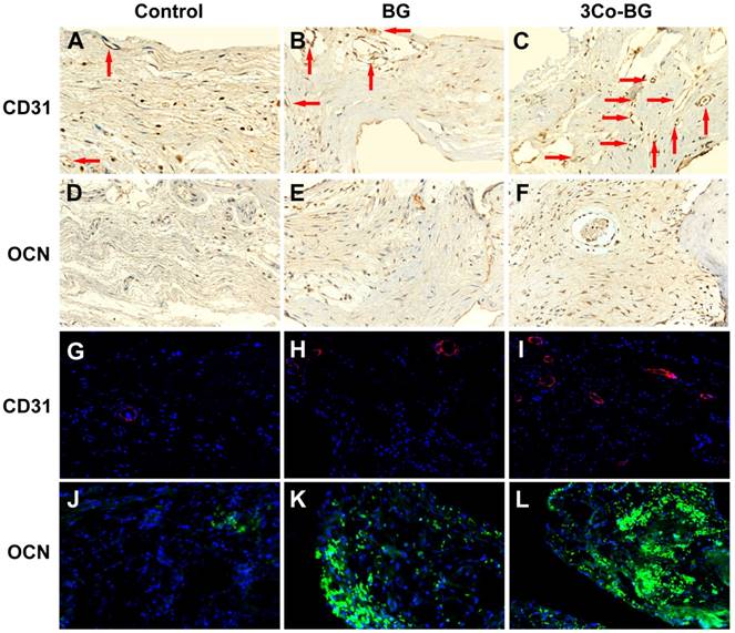 Hypoxia Mimicking Cobalt Doped Borosilicate Bioactive Glass Scaffolds With Enhanced Angiogenic And Osteogenic Capacity For Bone Regeneration
