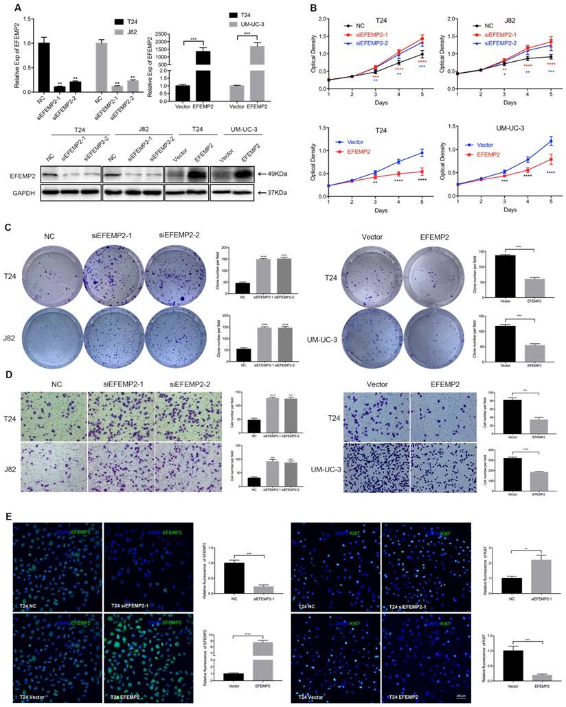 Efemp2 Suppresses Epithelial Mesenchymal Transition Via Wnt B Catenin Signaling Pathway In Human Bladder Cancer
