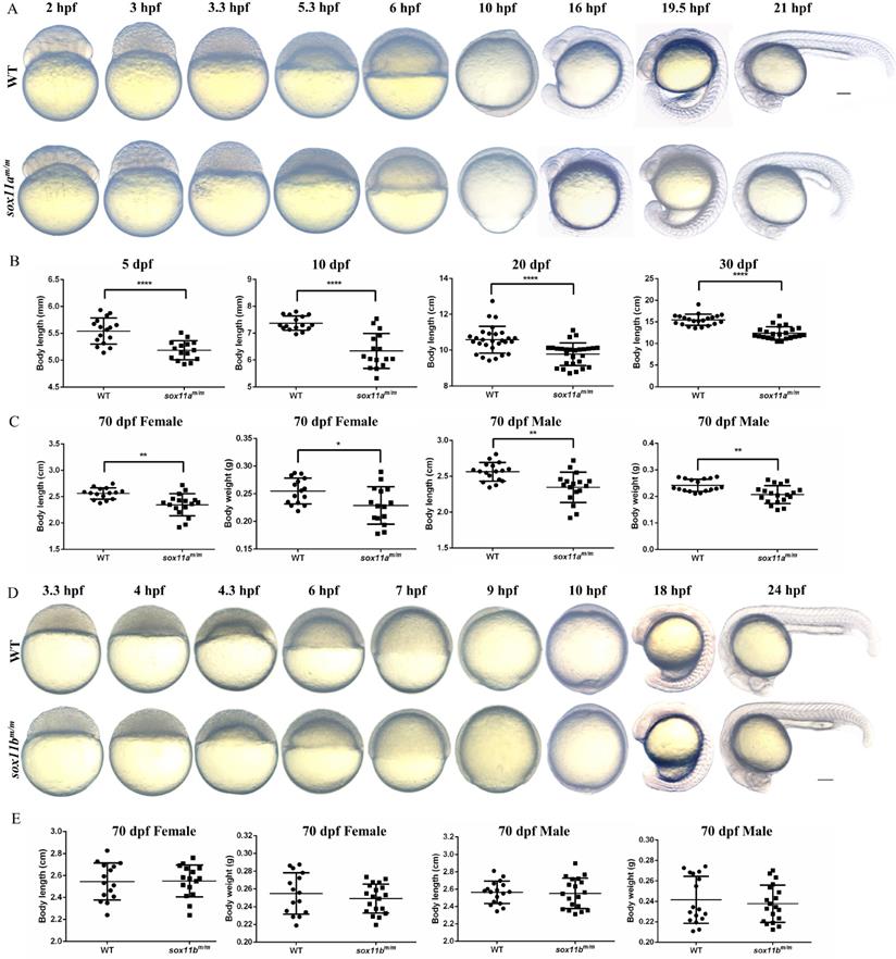 Multiple Developmental Defects in sox11a Mutant Zebrafish with Features