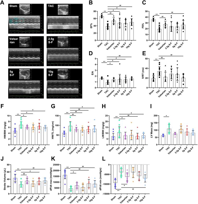 Regulation Of Energy Metabolism By Combination Therapy Attenuates Cardiac Metabolic Remodeling In Heart Failure