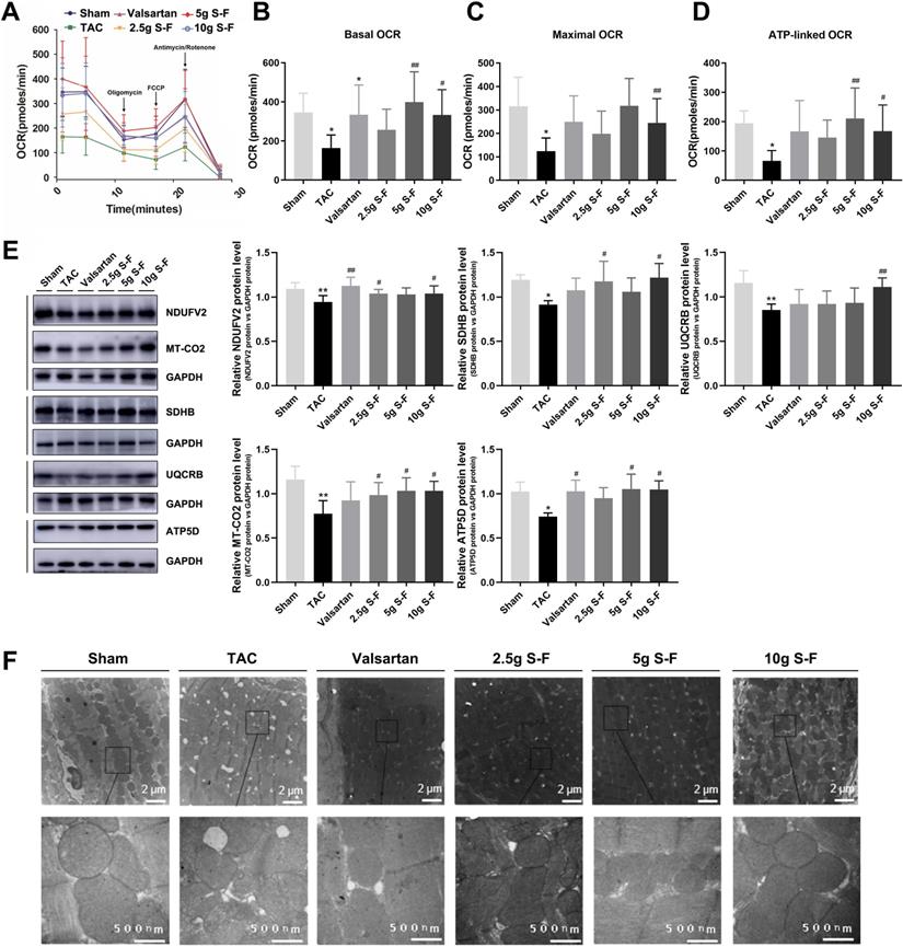 Regulation Of Energy Metabolism By Combination Therapy Attenuates Cardiac Metabolic Remodeling In Heart Failure