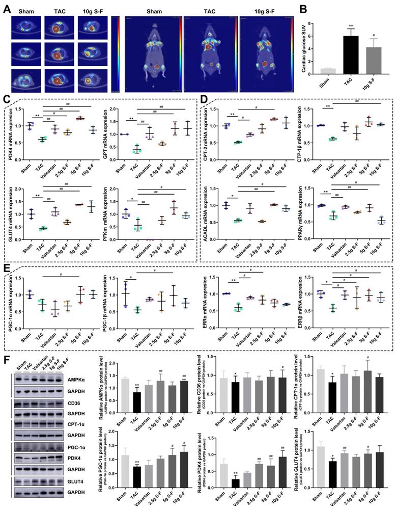 Regulation Of Energy Metabolism By Combination Therapy Attenuates Cardiac Metabolic Remodeling In Heart Failure