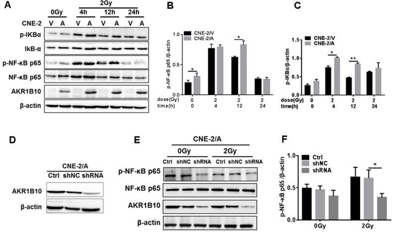 Akr1b10 Confers Resistance To Radiotherapy Via Ffa Tlr4 Nf Kb Axis In Nasopharyngeal Carcinoma